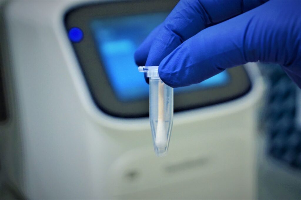 Skin DNA swab eppendorf and PCR machine